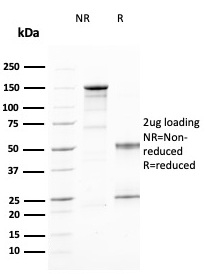 CD25 / IL2RA Monoclonal Mouse Antibody (IL2RA/2394)