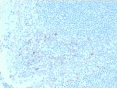 CD25/ IL2RA Monoclonal Mouse Antibody (IL2RA/2395)