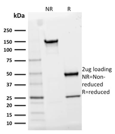 CD25/ IL2RA Monoclonal Mouse Antibody (IL2RA/2395)