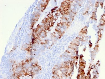 CD262 / DR5 Monoclonal Mouse Antibody (DR5/3381)