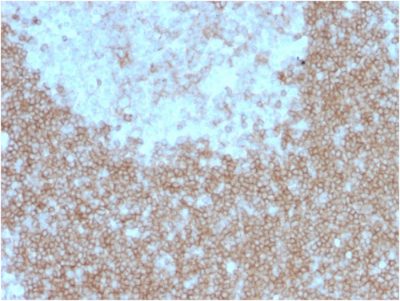 CD268 / BAFFR / TNFRSF13C Monoclonal Mouse Antibody (BAFFR/1557)