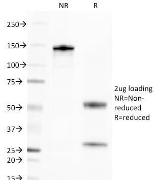 CD269 / TNFRSF17 / BCMA Monoclonal Mouse Antibody (BCMA/2366)