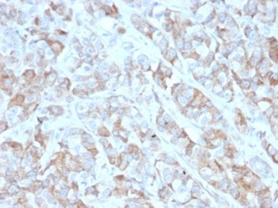 CD269 / TNFRSF17 / BCMA Monoclonal Mouse Antibody (BCMA/2366)