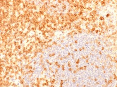 CD27 Recombinant Monoclonal Mouse Antibody (rLPFS2/1611)