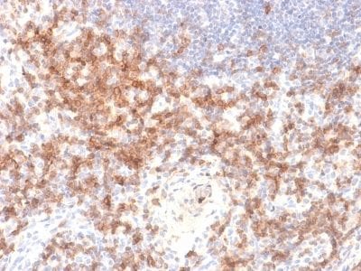 CD27 Recombinant Monoclonal Rabbit Antibody (LPFS2/2034R)