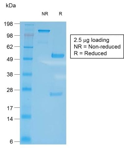 CD27 Recombinant Monoclonal Rabbit Antibody (LPFS2/2034R)