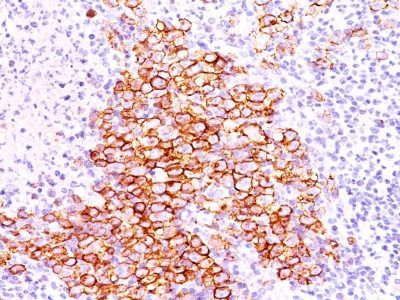 CD30 / TNFRSF8 Monoclonal Mouse Antibody (CD30/412)