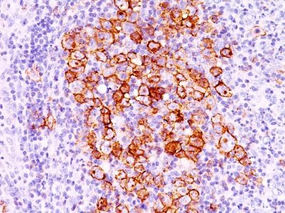 CD30 / TNFRSF8 Monoclonal Mouse Antibody (CD30/412)