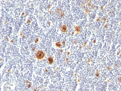 CD30 / TNFRSF8 Monoclonal Mouse Antibody (Ki-1/779)