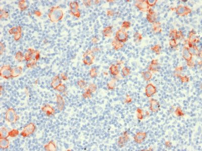 CD30 / TNFRSF8 Recombinant Monoclonal Mouse Antibody (rCD30/412)