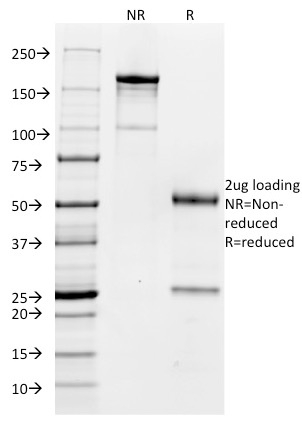 CD32 Monoclonal Mouse Antibody (FCGR2A/479)