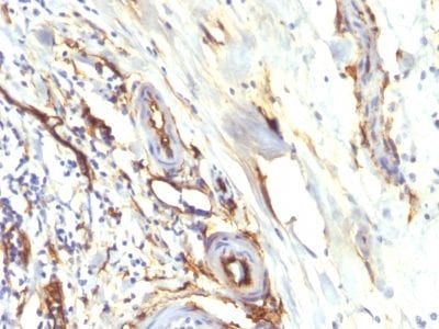 CD34 Recombinant Monoclonal Rabbit Antibody (HPCA1/2598R)