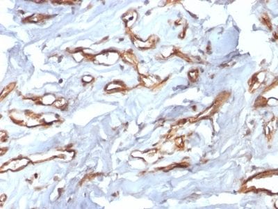 CD34 Recombinant Monoclonal Rabbit Antibody (HPCA1/2598R)