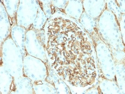 CD34 Recombinant Monoclonal Rabbit Antibody (HPCA1/2598R)