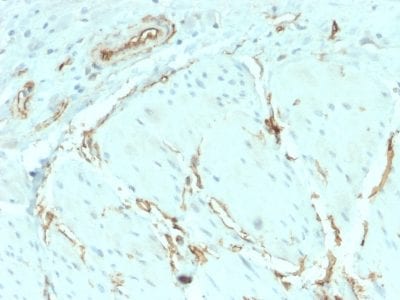 CD34 Recombinant Monoclonal Rabbit Antibody (HPCA1/2598R)