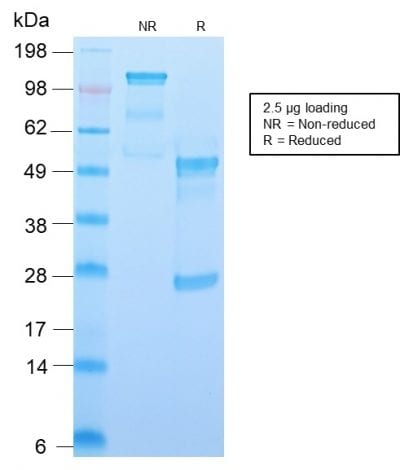 CD34 Recombinant Monoclonal Rabbit Antibody (HPCA1/2598R)