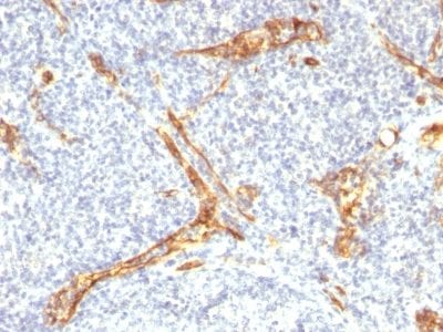 CD34 Recombinant Monoclonal Rabbit Antibody (HPCA1/2598R)