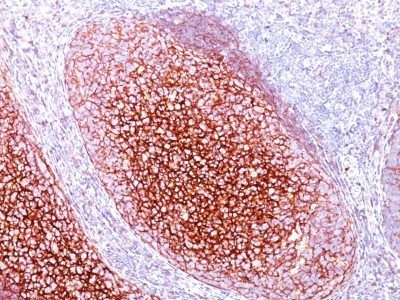 CD35 / CR1 Monoclonal Mouse Antibody (CR1/802)