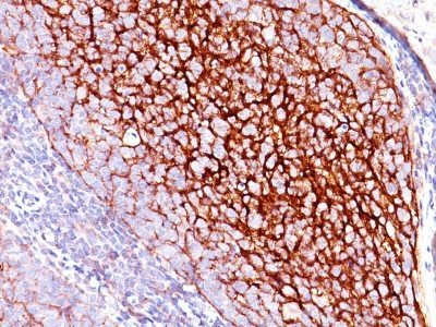 CD35 / CR1 Monoclonal Mouse Antibody (E11)