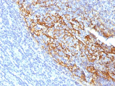 CD35 / CR1 Monoclonal Mouse Antibody (To5)