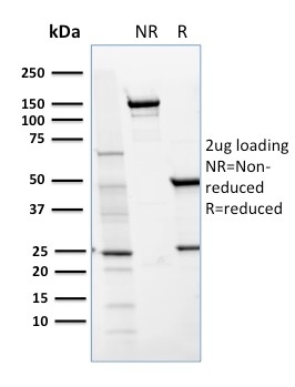 CD36 Monoclonal Mouse Antibody (GPIIIb/1654)