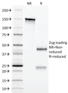 CD3e Monoclonal Mouse Antibody (C3e/2479)