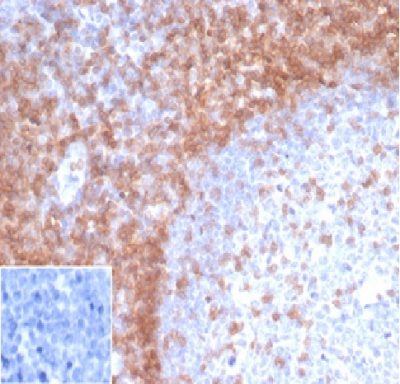 CD3e Recombinant Monoclonal Mouse Antibody (rC3e/1931)