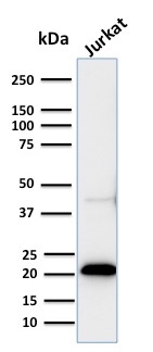 CD3e Recombinant Monoclonal Rabbit Antibody (C3e/2858R)