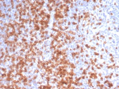 CD3e Recombinant Monoclonal Rabbit Antibody (C3e/3125R)