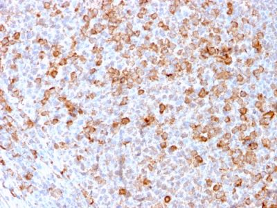 CD3e Recombinant Monoclonal Rabbit Antibody (C3e/3171R)