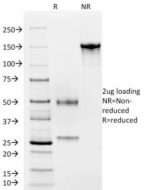 CD4 Monoclonal Mouse Antibody (C4/206)