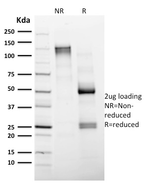 CD4 Monoclonal Mouse Antibody (CD4/1604)