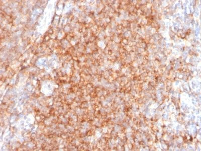 CD40 / TNFRSF5 Monoclonal Mouse Antibody (C40/2383)