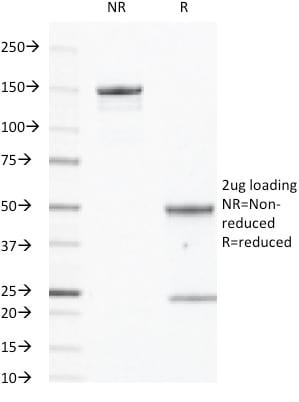 CD40 / TNFRSF5 Monoclonal Mouse Antibody (C40/2383)