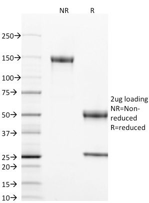 CD40 / TNFRSF5 Monoclonal Mouse Antibody (T8P2G4*A6)