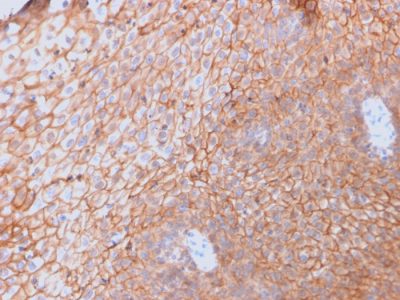 CD40 Ligand / CD154 / TRAP1 Monoclonal Mouse Antibody (CD40LG/2761)