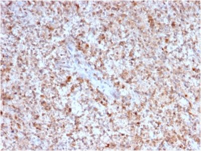 CD40 Ligand / CD154 / TRAP1 Monoclonal Mouse Antibody (CD40LG/2763)