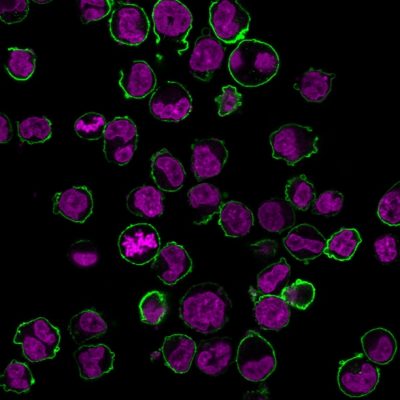 CD43 Monoclonal Mouse Antibody (84-3C1)