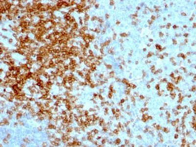 CD43 Monoclonal Mouse Antibody (84-3C1)