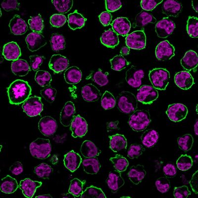 CD43 Monoclonal Mouse Antibody (Bra7G)