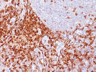 CD43 Monoclonal Mouse Antibody (Bra7G)