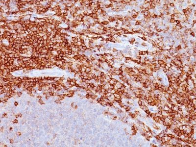 CD43 Monoclonal Mouse Antibody (DF-T1)