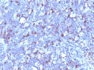 CD43 Monoclonal Mouse Antibody (SPN/1094) 