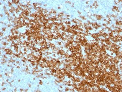 CD43 Monoclonal Mouse Antibody (SPN/1094) 