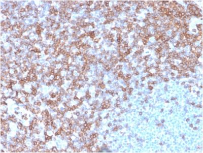 CD43 Monoclonal Mouse Antibody (SPN/3388)