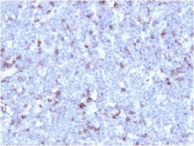 CD43 Recombinant Monoclonal Mouse Antibody (rSPN/1094)