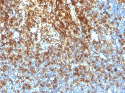 CD43 Recombinant Monoclonal Rabbit Antibody (SPN/1766R)