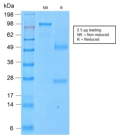 CD43 Recombinant Monoclonal Rabbit Antibody (SPN/2049R)