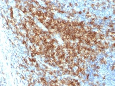 CD43 Recombinant Monoclonal Rabbit Antibody (SPN/2049R)