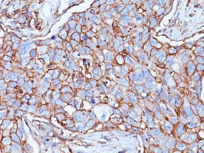 CD44 Standard Monoclonal Mouse Antibody (156-3C11)